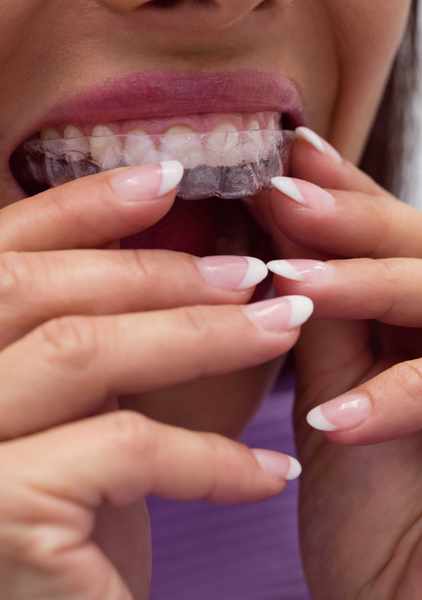 Tooth extraction