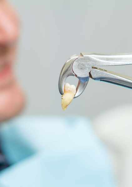 Gum treatment